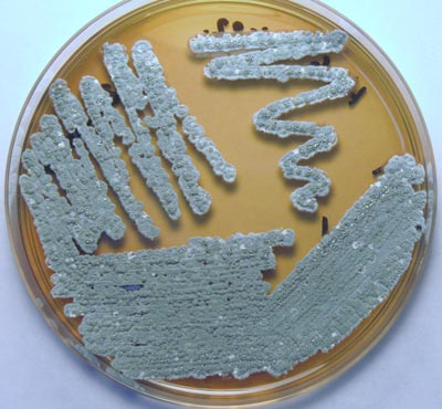 Streptomyces sp A1. Fotografia del Dr. Zahaed Evangelista Martinez