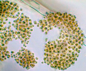 Cianobacteria 12