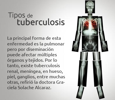 tuberculosisYu recuadros 01