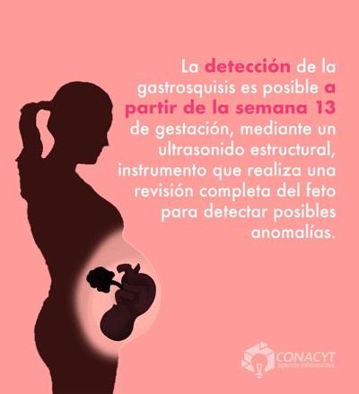 deteccion gastrosquisis